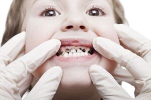 pediatric dentist montovia